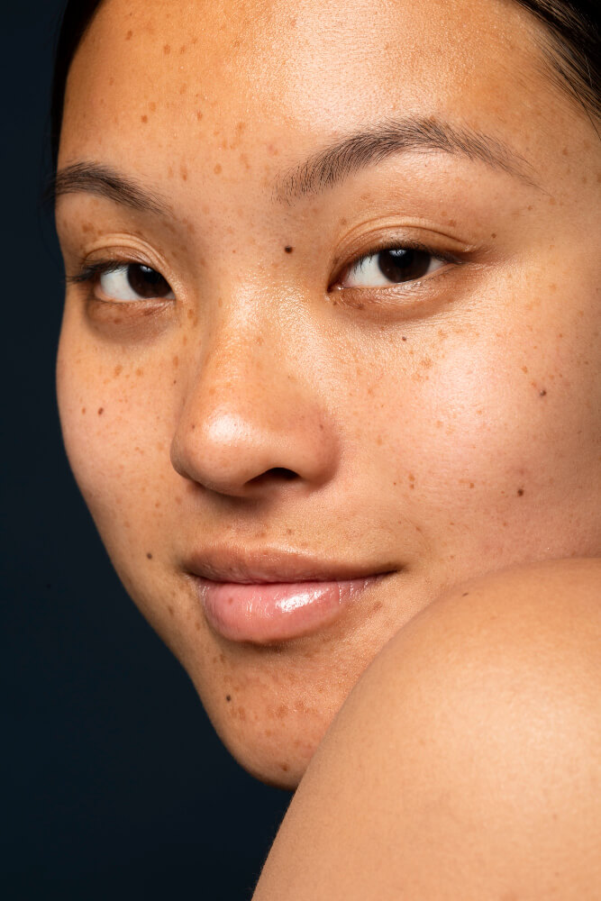 Moles
