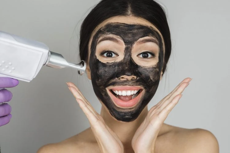 Carbon Peel Carbon Peel