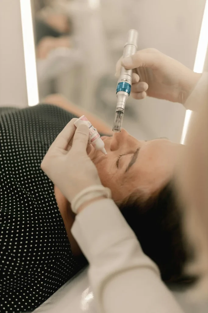 Infini RF Microneedling Infini RF Microneedling