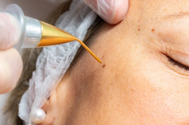 Jet Plasma Jet Plasma