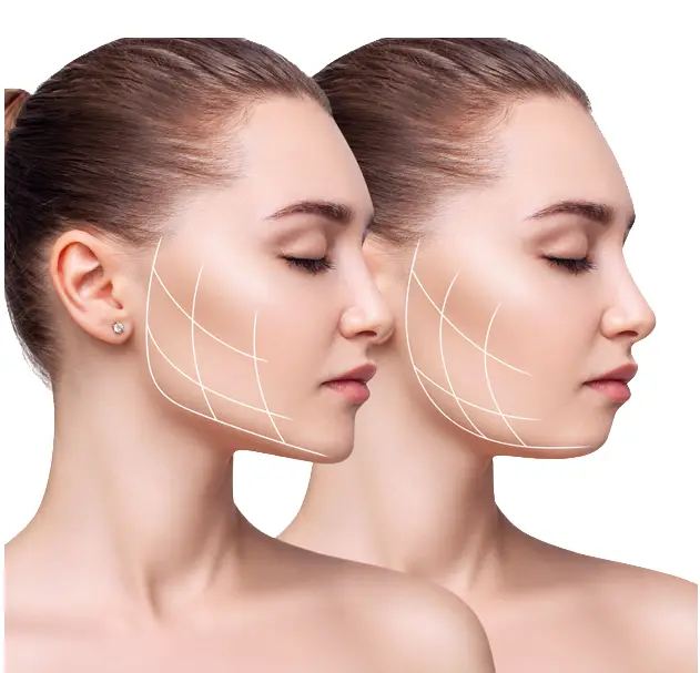 Double Chin Reduction Double Chin Reduction