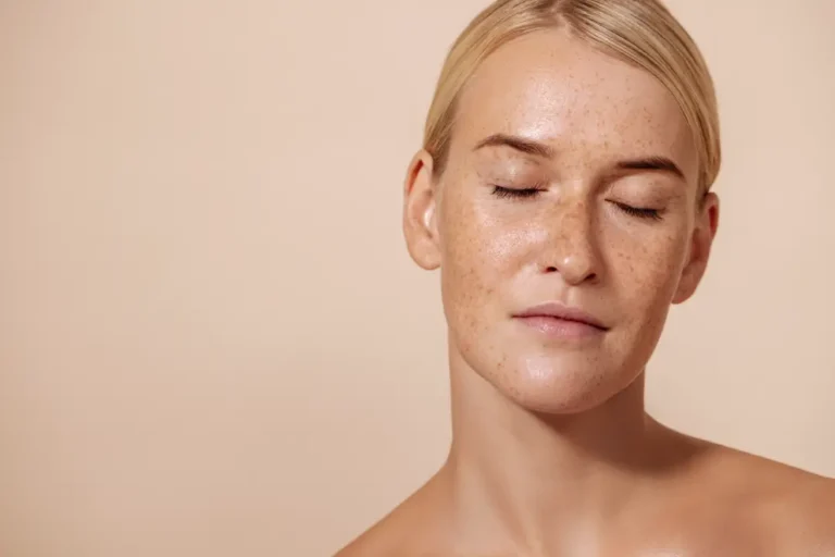 Pigmentation