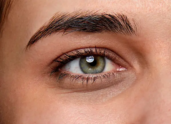 Undereye Treatments
