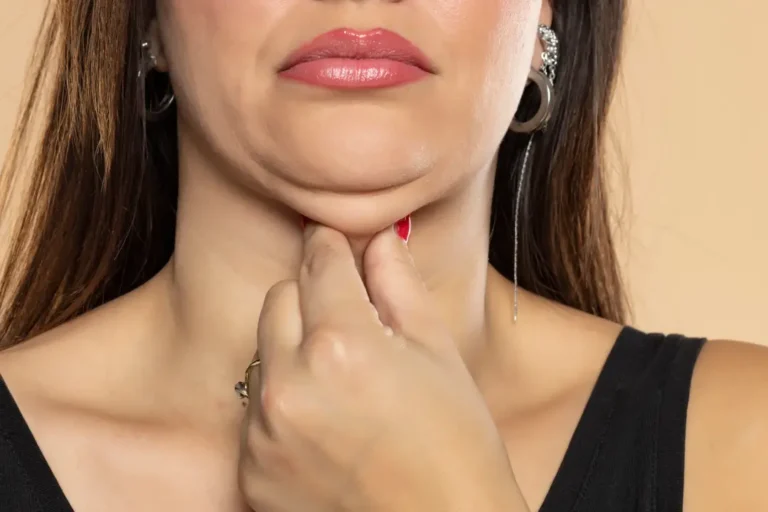 Double Chin