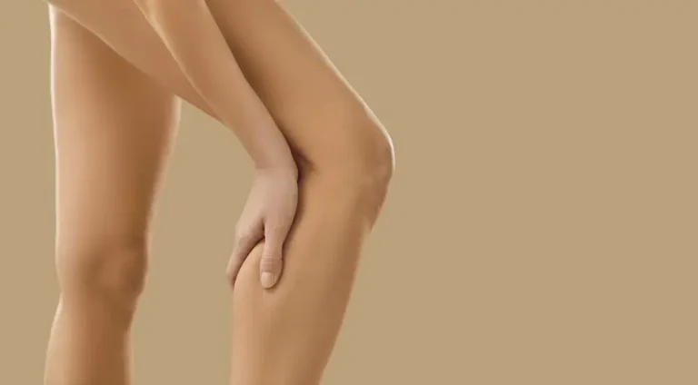 Calves