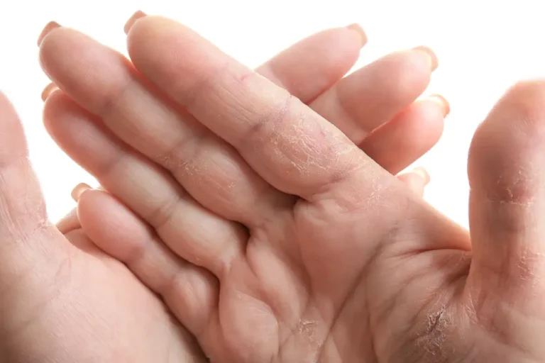 Hand treatments