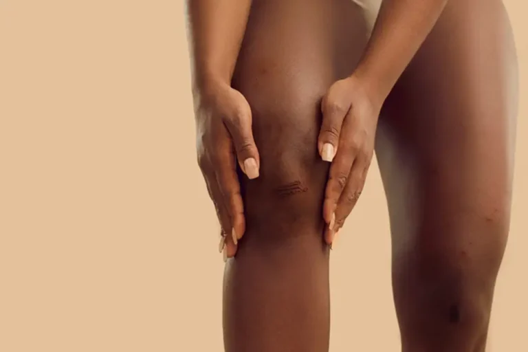 Knees Pigmentation