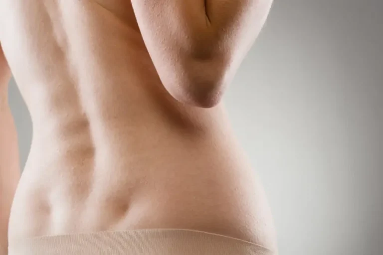 Love Handles