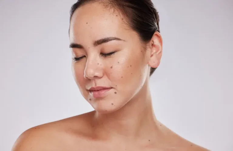 Moles