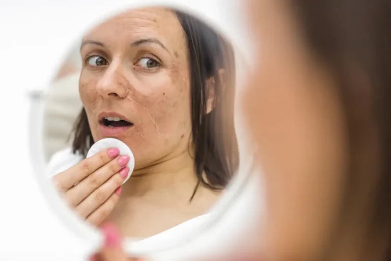 Pigmentation