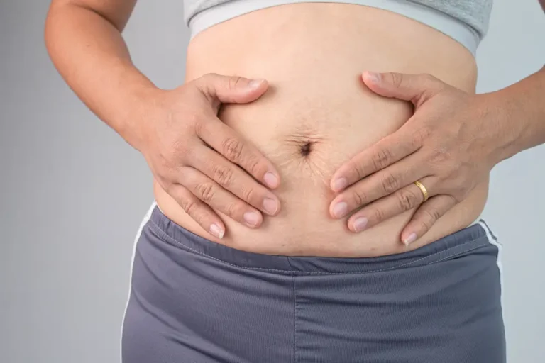 Post-Lipolysis Care