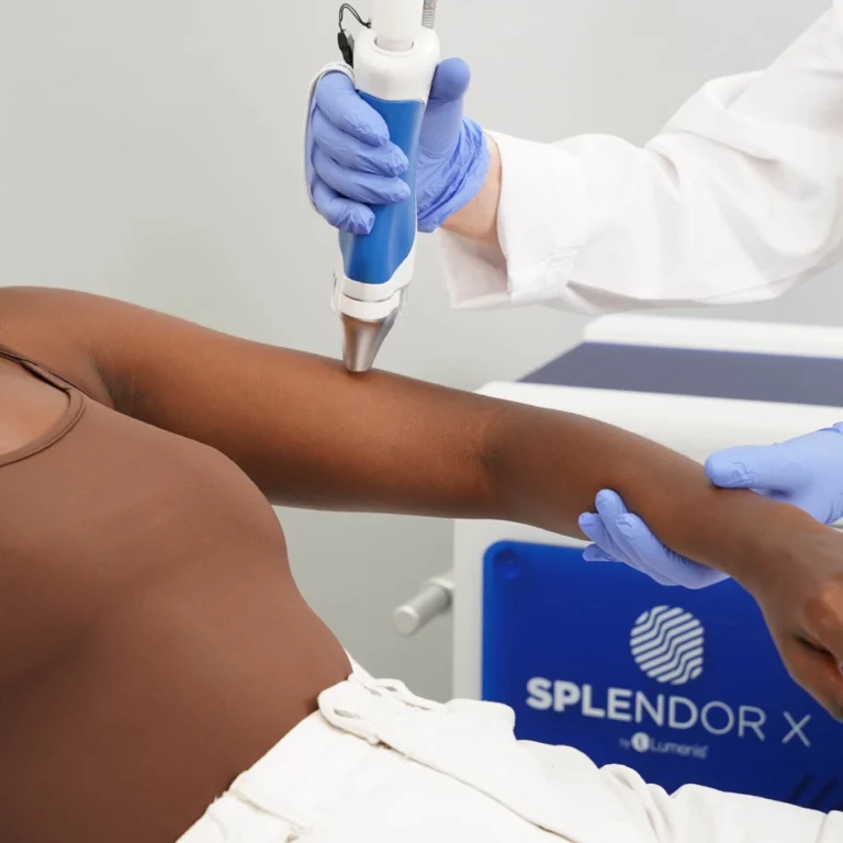 Laser Hair Removal