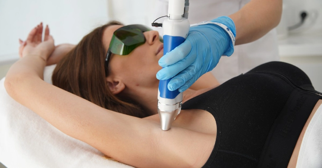 Laser Hair Removal
