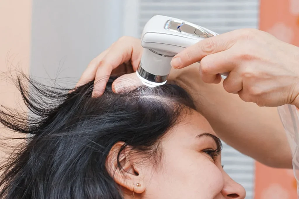 Exosomes for Hair & Scalp Health